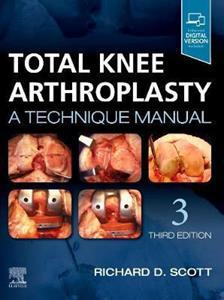TOTAL KNEE ARTHROPLASTY : A TECHNIQUE MANUAL